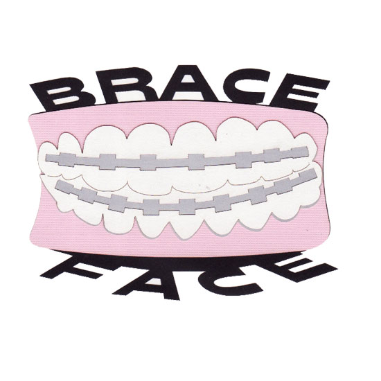 W2S - Brace Face - Smile with chrome braces!